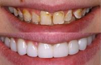 Open Late Dentistry and Orthodontics image 9